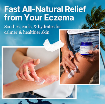 Eczema relief Sea moss